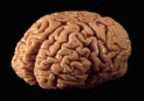 a picture of a brain